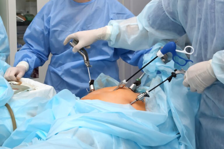 Laparoscopy